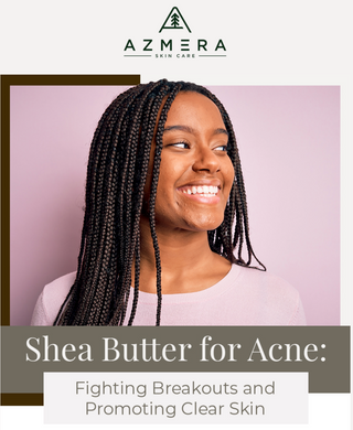 SHEA BUTTER FOR ACNE